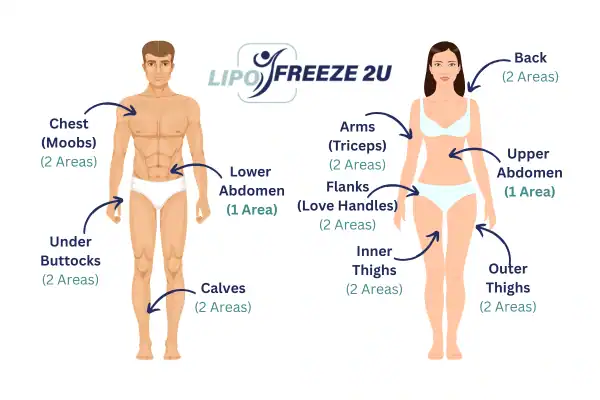 Areas you can have fat freezing treatment Byfleet