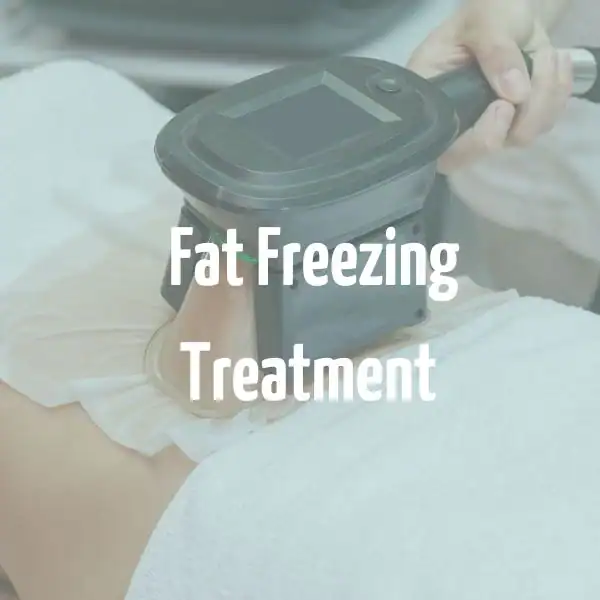 fat freezing treatment Byfleet
